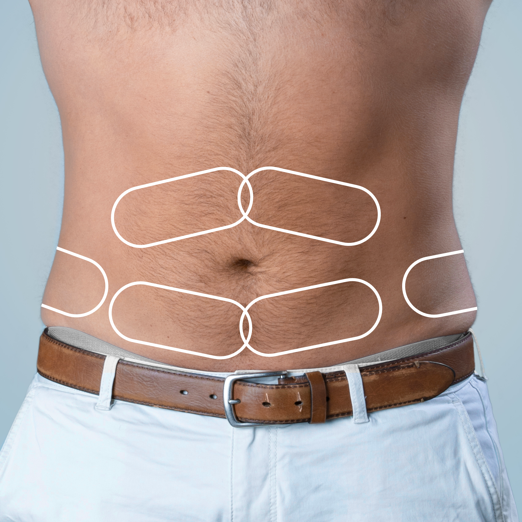 Illustration highlighting abdomen and flank treatment areas
